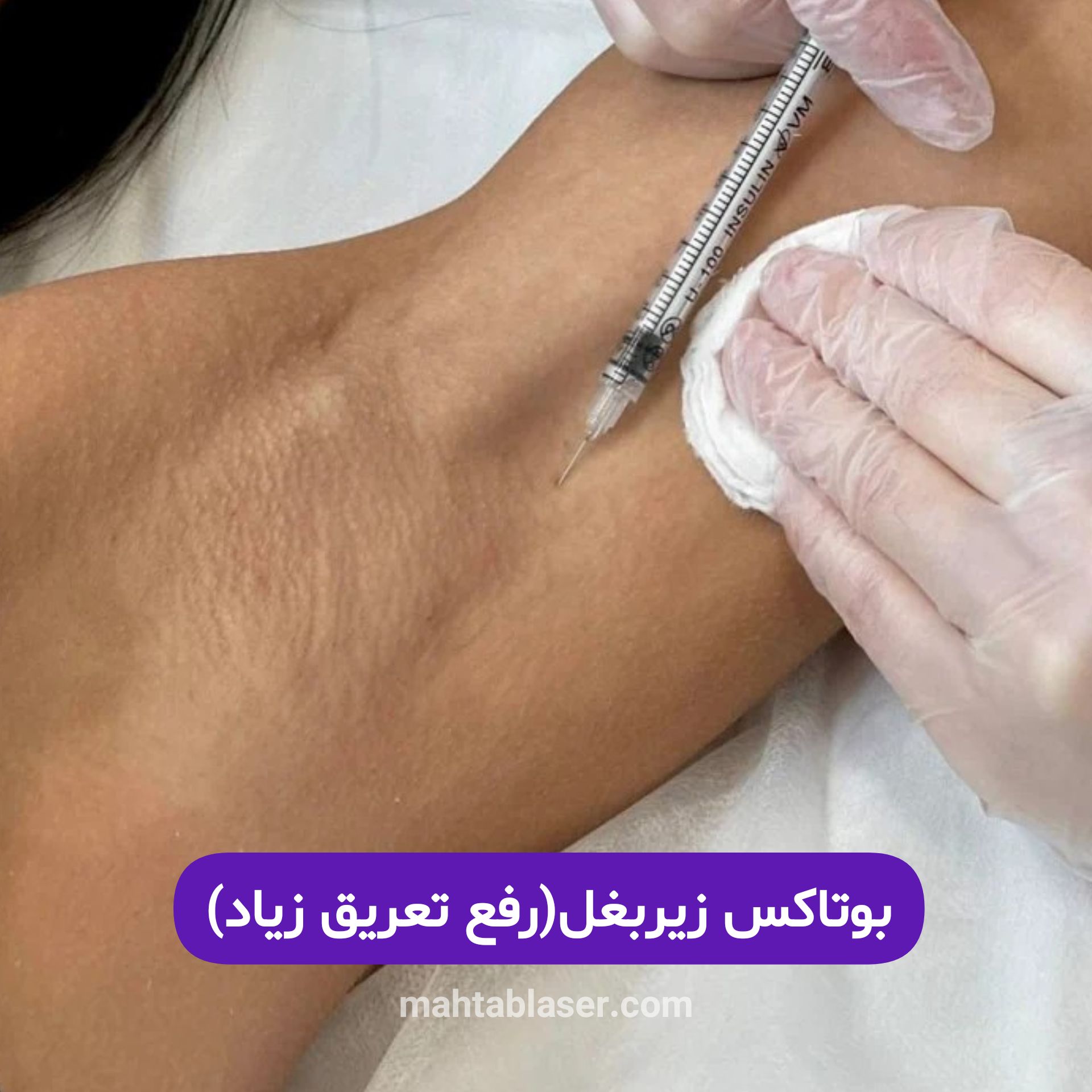 تزریق بوتاکس در رشت