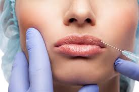 مزایا و معایب ژل و بوتاکس در استان گیلان شهر رشت