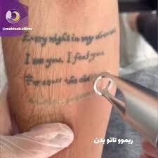 پاک سازی تتو و خالکوبی