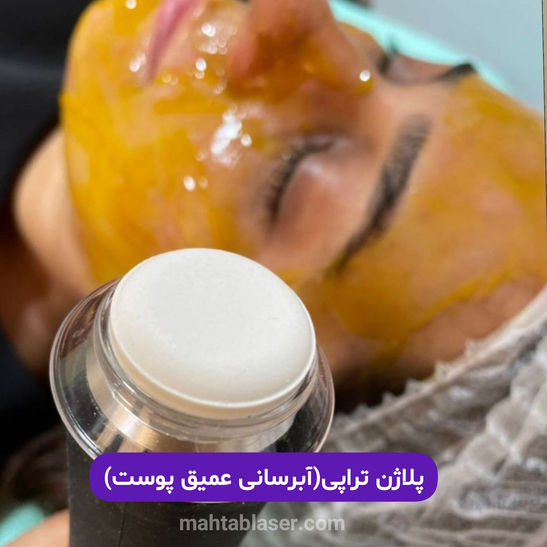 پلاژن تراپی برای جوانسازی و شادابی پوست در استان گیلان شهر رشت