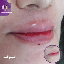 کلینیک زیبایی در مهرگان قزوین