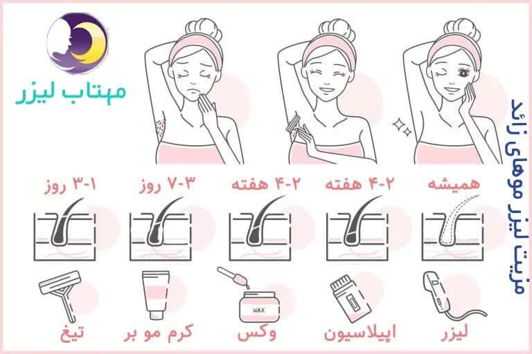 مزیت لیزر موهای زائد