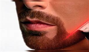 لیزر مو زائد برای اقایان در نیاوران